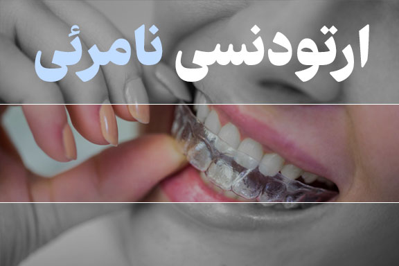 ارتودنسی نامرئی